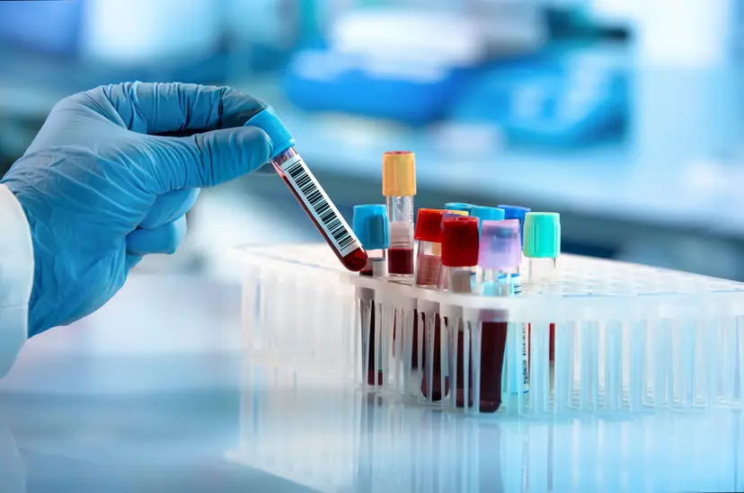 Challenges of Liquid Biopsy Assay Validation and Quality Control Webinar